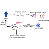 <b>【佳学基因检测】如何利用诱导多能干细胞（iPSC)进行遗传病的基因矫正治疗</b>