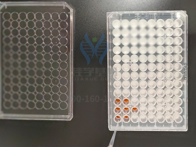 <b>【佳学基因检测】知道CYP24A1的这些内容，是疾病筛查全面性一个准备</b>