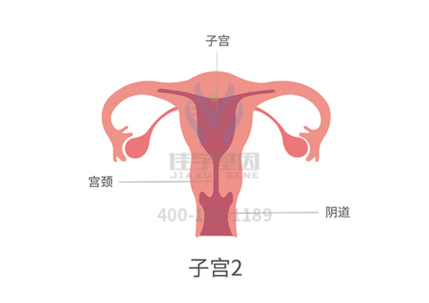 【佳学基因-基因检测】一种没有先期征兆的恶性肿瘤：卵巢癌，正逐渐趋于年