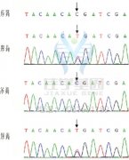 DVL1P1突变检测找到病因后应该用什么靶向药物？